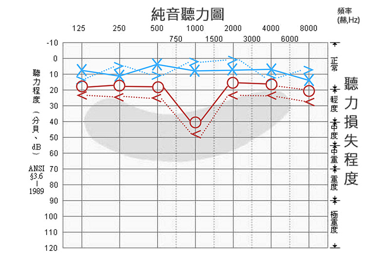 聽力檢查結果評估範本