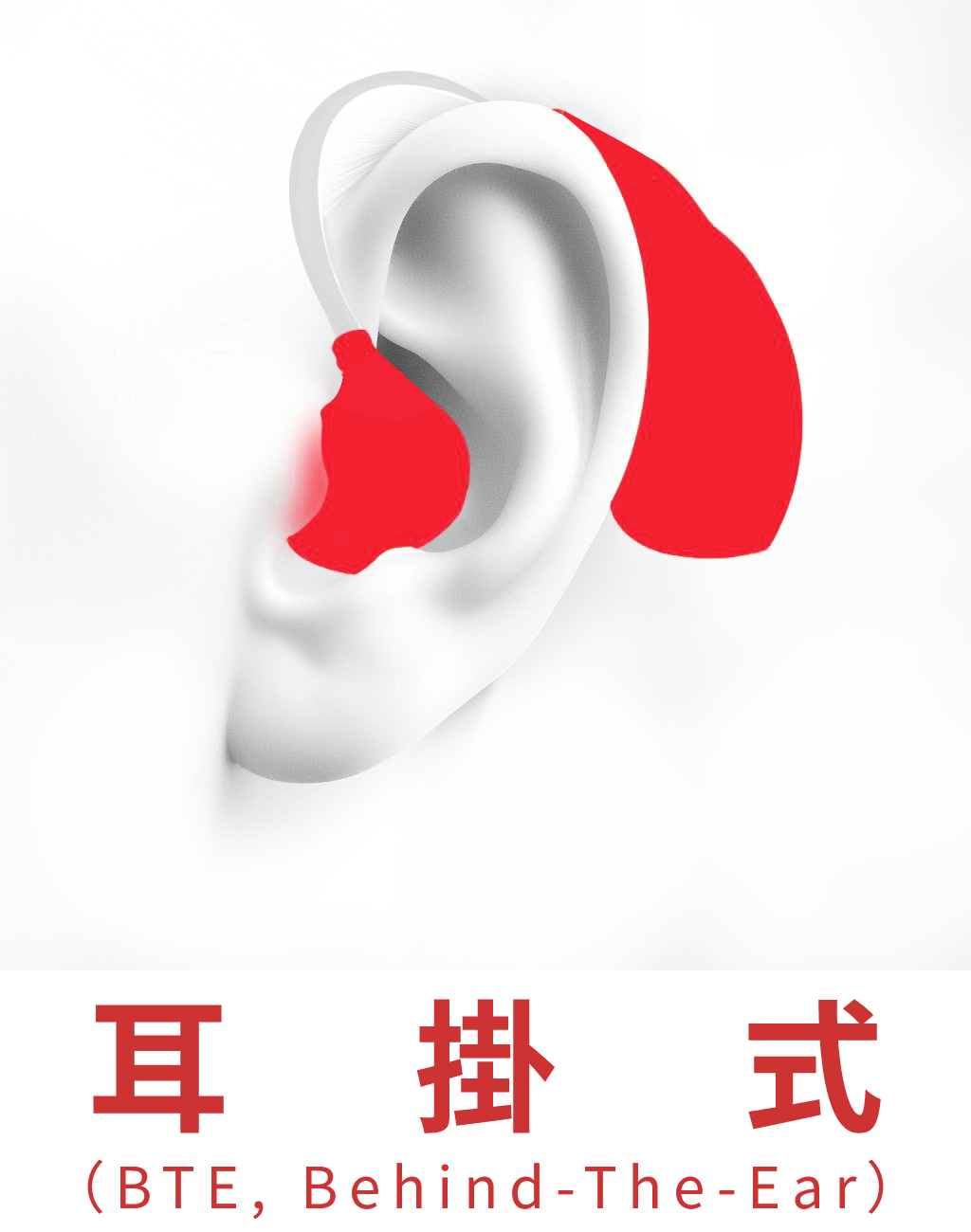 耳掛型（BTE）
