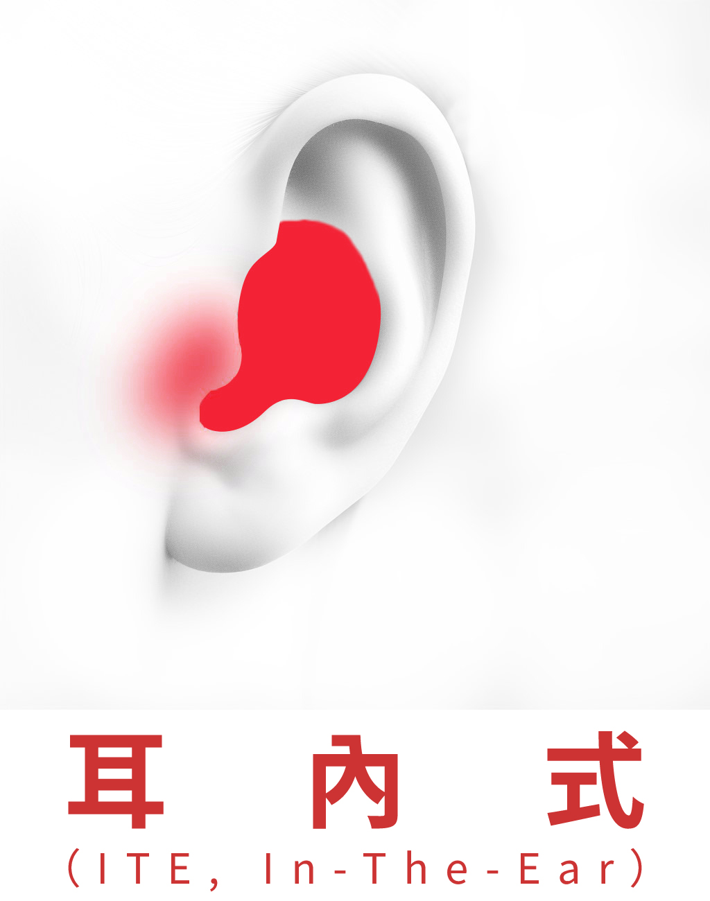 耳內型（ITE）